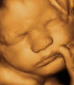 3D/4D Scan - Between 26 - 32 Weeks  (Incl Gender and Baby Growth Scan)